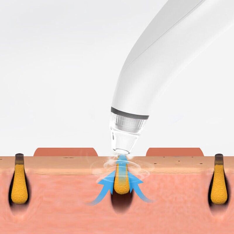 Electric Blackhead Remover Cleaner Face Diamond Pore Vacuum Suction