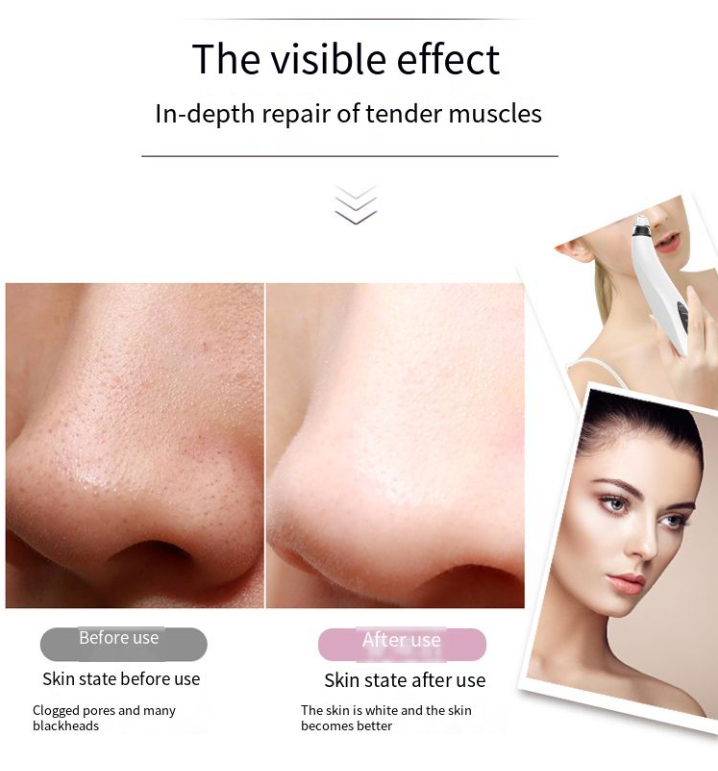 Electric Blackhead Remover Cleaner Face Diamond Pore Vacuum Suction