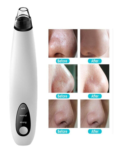 Electric Blackhead Remover Cleaner Face Diamond Pore Vacuum Suction